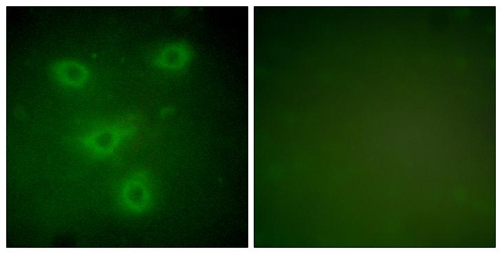 KRT14 / CK14 / Cytokeratin 14 Antibody - Peptide - + Immunofluorescence analysis of NIH/3T3 cells, using Keratin 14 antibody.