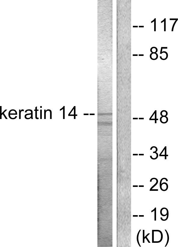 KRT14 / CK14 / Cytokeratin 14 Antibody - Western blot analysis of extracts from NIH/3T3 cells, using Keratin 14 antibody.