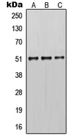 KRT14 / CK14 / Cytokeratin 14 Antibody - Western blot analysis of Cytokeratin 14 expression in MCF7 (A); mouse brain (B); rat brain (C) whole cell lysates.