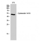 KRT14/KRT16 Antibody - Western blot of Cytokeratin 14/16 antibody