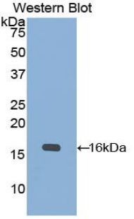 KRT15 / CK15 / Cytokeratin 15 Antibody - Western blot of recombinant KRT15 / Cytokeratin 15.  This image was taken for the unconjugated form of this product. Other forms have not been tested.