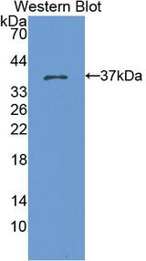 KRT15 / CK15 / Cytokeratin 15 Antibody - Western Blot; Sample: Recombinant protein.