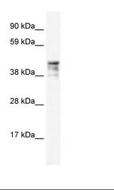 KRT15 / CK15 / Cytokeratin 15 Antibody - Fetal Thymus Lysate.  This image was taken for the unconjugated form of this product. Other forms have not been tested.
