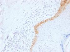 KRT15 / CK15 / Cytokeratin 15 Antibody - IHC testing of FFPE human skin with Keratin 15 antibody (clone LHK15). Required HIER: boil tissue sections in 10mM citrate buffer, pH 6, for 10-20 min.