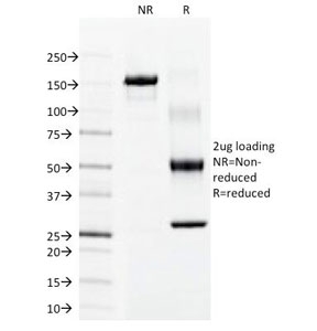 KRT15 / CK15 / Cytokeratin 15 Antibody - SDS-PAGE Analysis of Purified, BSA-Free Keratin 15 Antibody (clone LHK15). Confirmation of Integrity and Purity of the Antibody.