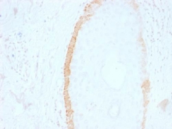 KRT15 / CK15 / Cytokeratin 15 Antibody - IHC testing of FFPE human skin with Cytokeratin 15 antibody (clone SPM190). Required HIER: boil tissue sections in 10mM citrate buffer, pH 6, for 10-20 min.
