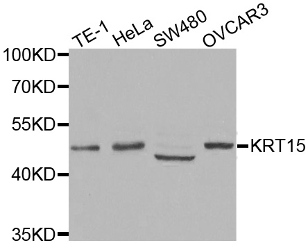 KRT15 / CK15 / Cytokeratin 15 Antibody - Western blot analysis of extracts of various cell lines.