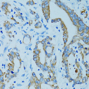 KRT15 / CK15 / Cytokeratin 15 Antibody - Immunohistochemistry of paraffin-embedded human colon carcinoma tissue.