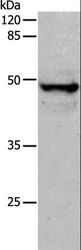 KRT15 / CK15 / Cytokeratin 15 Antibody - Western blot analysis of Mouse thymus tissue, using KRT15 Polyclonal Antibody at dilution of 1:400.