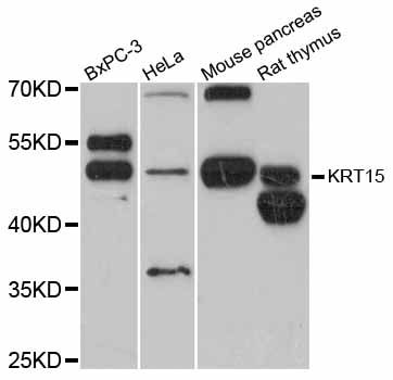 KRT15 / CK15 / Cytokeratin 15 Antibody - Western blot analysis of extracts of various cell lines, using KRT15 antibody at 1:3000 dilution. The secondary antibody used was an HRP Goat Anti-Rabbit IgG (H+L) at 1:10000 dilution. Lysates were loaded 25ug per lane and 3% nonfat dry milk in TBST was used for blocking. An ECL Kit was used for detection and the exposure time was 90s.