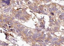 KRT15 / CK15 / Cytokeratin 15 Antibody - 1:100 staining human breast tissue by IHC-P. The tissue was formaldehyde fixed and a heat mediated antigen retrieval step in citrate buffer was performed. The tissue was then blocked and incubated with the antibody for 1.5 hours at 22°C. An HRP conjugated goat anti-rabbit antibody was used as the secondary.