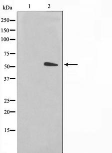 KRT15 / CK15 / Cytokeratin 15 Antibody - Western blot analysis on COS7 cell lysates using Keratin 15 antibody. The lane on the left is treated with the antigen-specific peptide.