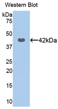 KRT16 / CK16 / Cytokeratin 16 Antibody - Western Blot; Sample: Recombinant protein.