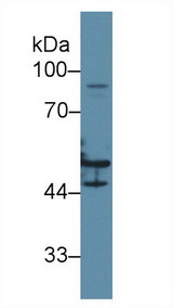 KRT16 / CK16 / Cytokeratin 16 Antibody - Western Blot; Sample: Human Hela cell lysate; Primary Ab: 2µg/ml Rabbit Anti-Human KRT16 Antibody Second Ab: 0.2µg/mL HRP-Linked Caprine Anti-Rabbit IgG Polyclonal Antibody
