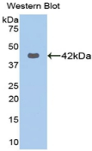 KRT16 / CK16 / Cytokeratin 16 Antibody - Western blot of recombinant KRT16 / Cytokeratin 16.  This image was taken for the unconjugated form of this product. Other forms have not been tested.