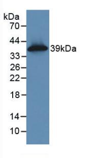 KRT16 / CK16 / Cytokeratin 16 Antibody - Western Blot; Sample: Recombinant KRT16, Human.