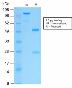 KRT16 / CK16 / Cytokeratin 16 Antibody - SDS-PAGE Analysis Purified Cytokeratin 16 Rabbit Recombinant Monoclonal Antibody (KRT16/2043R). Confirmation of Purity and Integrity of Antibody.