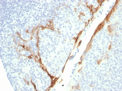 KRT16 / CK16 / Cytokeratin 16 Antibody - Formalin-fixed, paraffin-embedded human Tonsil stained with CK16 Mouse Recombinant Monoclonal Antibody (rKRT16/1714).