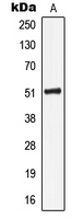KRT16 / CK16 / Cytokeratin 16 Antibody - Western blot analysis of Cytokeratin 16 expression in HeLa (A) whole cell lysates.