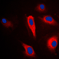 KRT16 / CK16 / Cytokeratin 16 Antibody - Immunofluorescent analysis of Cytokeratin 16 staining in HeLa cells. Formalin-fixed cells were permeabilized with 0.1% Triton X-100 in TBS for 5-10 minutes and blocked with 3% BSA-PBS for 30 minutes at room temperature. Cells were probed with the primary antibody in 3% BSA-PBS and incubated overnight at 4 C in a humidified chamber. Cells were washed with PBST and incubated with a DyLight 594-conjugated secondary antibody (red) in PBS at room temperature in the dark. DAPI was used to stain the cell nuclei (blue).
