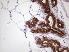 KRT16 / CK16 / Cytokeratin 16 Antibody - Immunohistochemical staining of paraffin-embedded Human breast tissue within the normal limits using anti-KRT16 mouse monoclonal antibody. (Heat-induced epitope retrieval by 1 mM EDTA in 10mM Tris, pH8.5, 120C for 3min. (1:150)