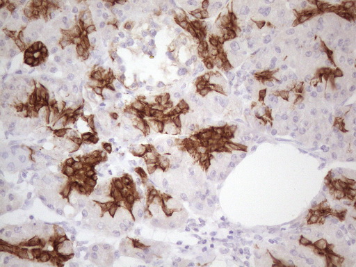 KRT16 / CK16 / Cytokeratin 16 Antibody - Immunohistochemical staining of paraffin-embedded Human pancreas tissue within the normal limits using anti-KRT16 mouse monoclonal antibody. (Heat-induced epitope retrieval by 1 mM EDTA in 10mM Tris, pH8.5, 120C for 3min. (1:150)