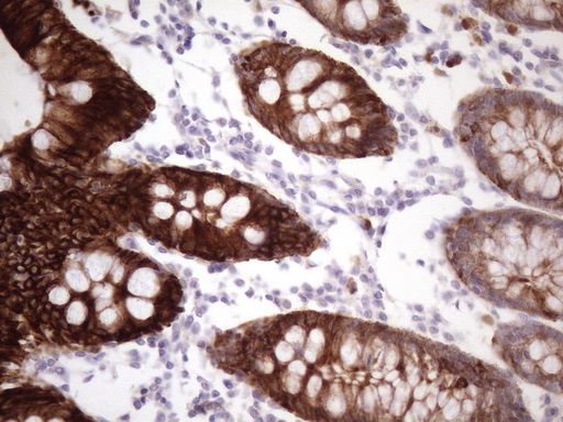 KRT16 / CK16 / Cytokeratin 16 Antibody - Immunohistochemical staining of paraffin-embedded Human colon tissue within the normal limits using anti-KRT16 mouse monoclonal antibody. (Heat-induced epitope retrieval by 1 mM EDTA in 10mM Tris, pH8.5, 120C for 3min. (1:150)