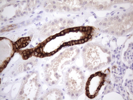 KRT16 / CK16 / Cytokeratin 16 Antibody - Immunohistochemical staining of paraffin-embedded Human Kidney tissue within the normal limits using anti-KRT16 mouse monoclonal antibody. (Heat-induced epitope retrieval by 1 mM EDTA in 10mM Tris, pH8.5, 120C for 3min. (1:150)