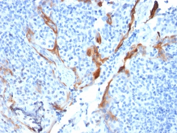 KRT16 / CK16 / Cytokeratin 16 Antibody - IHC testing of FFPE human tonsil with Cytokeratin 16 antibody (clone KRT16/1714). Required HIER: boil tissue sections in pH6, 10mM citrate buffer, for 10-20 min followed by cooling at RT for 20 min.