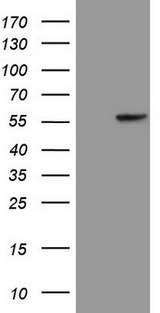 KRT16 / CK16 / Cytokeratin 16 Antibody - HEK293T cells were transfected with the pCMV6-ENTRY control (Left lane) or pCMV6-ENTRY KRT16 (Right lane) cDNA for 48 hrs and lysed. Equivalent amounts of cell lysates (5 ug per lane) were separated by SDS-PAGE and immunoblotted with anti-KRT16 (1:200)(1:500).