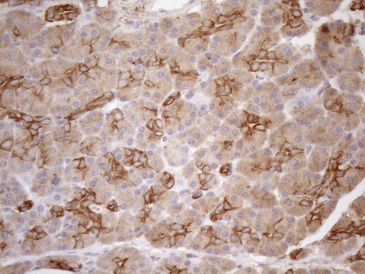 KRT16 / CK16 / Cytokeratin 16 Antibody - Immunohistochemical staining of paraffin-embedded Human pancreas tissue within the normal limits using anti-KRT16 mouse monoclonal antibody. (Heat-induced epitope retrieval by 1mM EDTA in 10mM Tris buffer. (pH8.5) at 120°C for 3 min. (1:150)