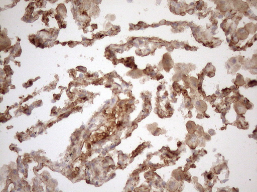 KRT16 / CK16 / Cytokeratin 16 Antibody - Immunohistochemical staining of paraffin-embedded Human lung tissue within the normal limits using anti-KRT16 mouse monoclonal antibody. (Heat-induced epitope retrieval by 1mM EDTA in 10mM Tris buffer. (pH8.5) at 120°C for 3 min. (1:150)