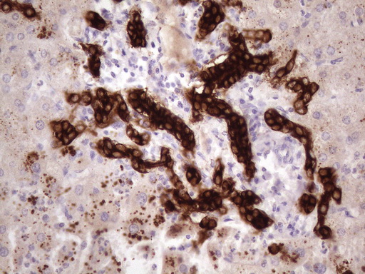 KRT16 / CK16 / Cytokeratin 16 Antibody - Immunohistochemical staining of paraffin-embedded Human liver tissue within the normal limits using anti-KRT16 mouse monoclonal antibody. (Heat-induced epitope retrieval by 1 mM EDTA in 10mM Tris, pH8.5, 120C for 3min. (1:150)