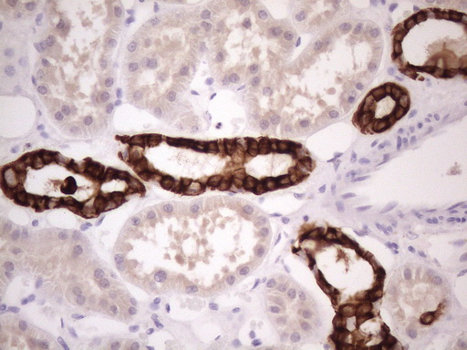 KRT16 / CK16 / Cytokeratin 16 Antibody - IHC of paraffin-embedded Human Kidney tissue using anti-KRT16 mouse monoclonal antibody. (Heat-induced epitope retrieval by 1 mM EDTA in 10mM Tris, pH8.5, 120°C for 3min)(1:150).