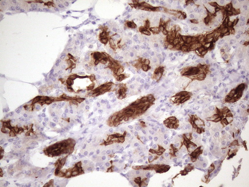 KRT16 / CK16 / Cytokeratin 16 Antibody - IHC of paraffin-embedded Human pancreas tissue using anti-KRT16 mouse monoclonal antibody. (Heat-induced epitope retrieval by 1 mM EDTA in 10mM Tris, pH8.5, 120°C for 3min)(1:150).