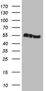 KRT16 / CK16 / Cytokeratin 16 Antibody - HEK293T cells were transfected with the pCMV6-ENTRY control. (Left lane) or pCMV6-ENTRY KRT16. (Right lane) cDNA for 48 hrs and lysed