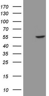 KRT16 / CK16 / Cytokeratin 16 Antibody - HEK293T cells were transfected with the pCMV6-ENTRY control (Left lane) or pCMV6-ENTRY KRT16 (Right lane) cDNA for 48 hrs and lysed. Equivalent amounts of cell lysates (5 ug per lane) were separated by SDS-PAGE and immunoblotted with anti-KRT16 (1:2000).