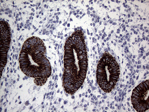 KRT16 / CK16 / Cytokeratin 16 Antibody - Immunohistochemical staining of paraffin-embedded Human endometrium tissue within the normal limits using anti-KRT16 mouse monoclonal antibody. (Heat-induced epitope retrieval by 1mM EDTA in 10mM Tris buffer. (pH8.5) at 120°C for 3 min. (1:2000)