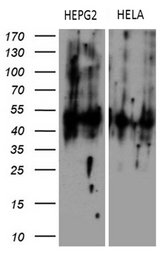 KRT16 / CK16 / Cytokeratin 16 Antibody - Western blot analysis of extracts. (35ug) from 2 different cell lines by using anti-KRT16 monoclonal antibody. (HepG2: human; HeLa: human).""(1:500)