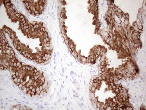 KRT16 / CK16 / Cytokeratin 16 Antibody - Immunohistochemical staining of paraffin-embedded Human prostate tissue within the normal limits using anti-KRT16 mouse monoclonal antibody. (Heat-induced epitope retrieval by 1mM EDTA in 10mM Tris buffer. (pH8.5) at 120°C for 3 min. (1:150)