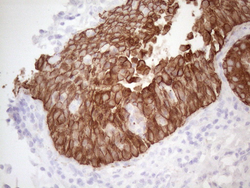 KRT16 / CK16 / Cytokeratin 16 Antibody - Immunohistochemical staining of paraffin-embedded Human bladder tissue within the normal limits using anti-KRT16 mouse monoclonal antibody. (Heat-induced epitope retrieval by 1mM EDTA in 10mM Tris buffer. (pH8.5) at 120°C for 3 min. (1:150)