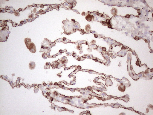 KRT16 / CK16 / Cytokeratin 16 Antibody - Immunohistochemical staining of paraffin-embedded Human lung tissue within the normal limits using anti-KRT16 mouse monoclonal antibody. (Heat-induced epitope retrieval by 1mM EDTA in 10mM Tris buffer. (pH8.5) at 120°C for 3 min. (1:150)