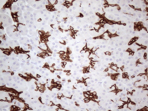 KRT16 / CK16 / Cytokeratin 16 Antibody - Immunohistochemical staining of paraffin-embedded Human pancreas tissue within the normal limits using anti-KRT16 mouse monoclonal antibody. (Heat-induced epitope retrieval by 1mM EDTA in 10mM Tris buffer. (pH8.5) at 120°C for 3 min. (1:150)