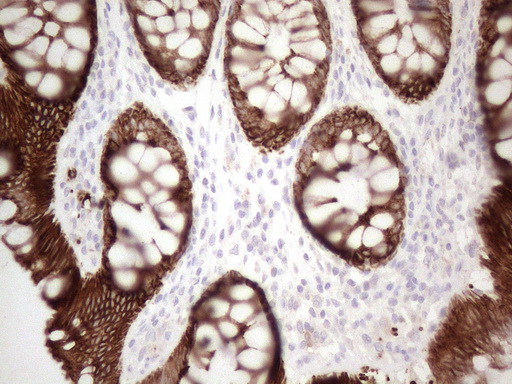 KRT16 / CK16 / Cytokeratin 16 Antibody - Immunohistochemical staining of paraffin-embedded Human colon tissue within the normal limits using anti-KRT16 mouse monoclonal antibody. (Heat-induced epitope retrieval by 1mM EDTA in 10mM Tris buffer. (pH8.5) at 120°C for 3 min. (1:150)