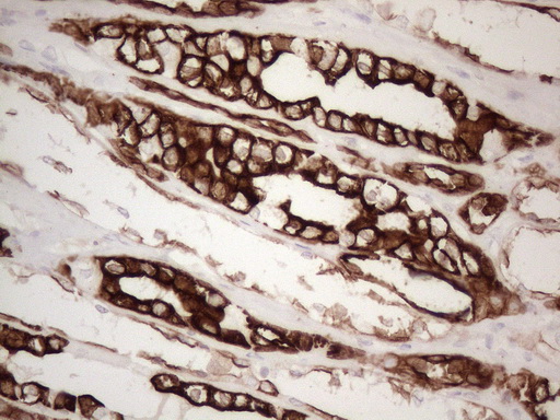 KRT16 / CK16 / Cytokeratin 16 Antibody - Immunohistochemical staining of paraffin-embedded Human Kidney tissue within the normal limits using anti-KRT16 mouse monoclonal antibody. (Heat-induced epitope retrieval by 1mM EDTA in 10mM Tris buffer. (pH8.5) at 120°C for 3 min. (1:150)
