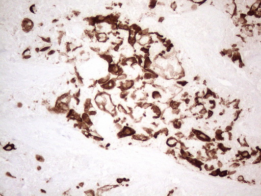 KRT16 / CK16 / Cytokeratin 16 Antibody - Immunohistochemical staining of paraffin-embedded Human liver tissue within the normal limits using anti-KRT16 mouse monoclonal antibody. (Heat-induced epitope retrieval by 1mM EDTA in 10mM Tris buffer. (pH8.5) at 120°C for 3 min. (1:150)