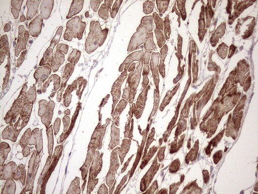 KRT16 / CK16 / Cytokeratin 16 Antibody - Immunohistochemical staining of paraffin-embedded Human adult heart tissue using anti-KRT16 mouse monoclonal antibody. (Heat-induced epitope retrieval by 1mM EDTA in 10mM Tris buffer. (pH8.5) at 120 oC for 3 min. (1:150)