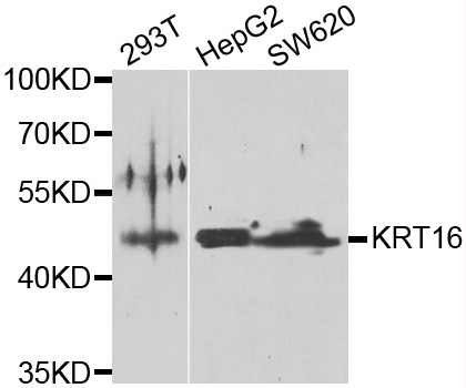 KRT16 / CK16 / Cytokeratin 16 Antibody - Western blot analysis of extracts of various cell lines.
