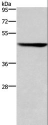 KRT16 / CK16 / Cytokeratin 16 Antibody - Western blot analysis of HeLa cell, using KRT16 Polyclonal Antibody at dilution of 1:450.