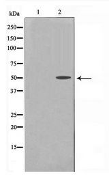 KRT16 / CK16 / Cytokeratin 16 Antibody - Western blot of HepG2 cell lysate using Keratin 16 Antibody